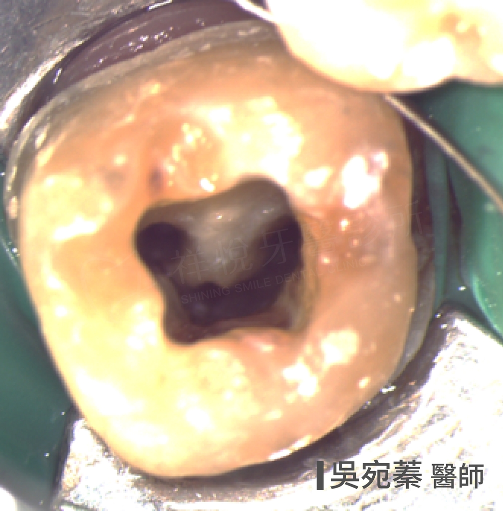 顯微鏡下視角