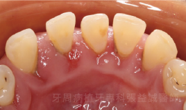 治療前