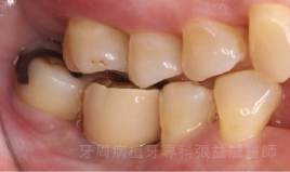 治療後