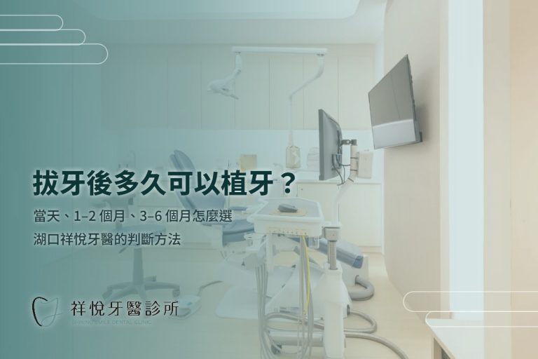拔牙後多久可以植牙？三種時機，評估那一次就會告訴你