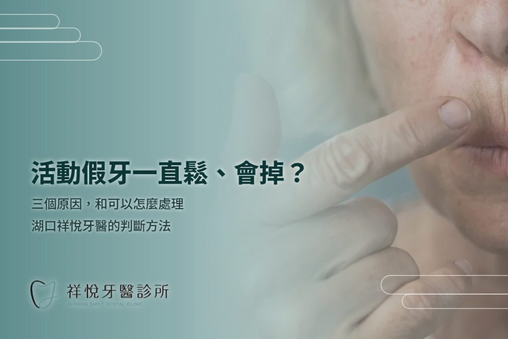活動假牙一直鬆、會掉?三個原因與處理方式|湖口祥悅牙醫