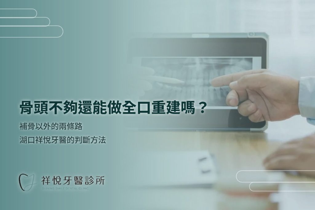 骨頭不夠還能做全口重建嗎?補骨以外的兩條路|湖口祥悅牙醫